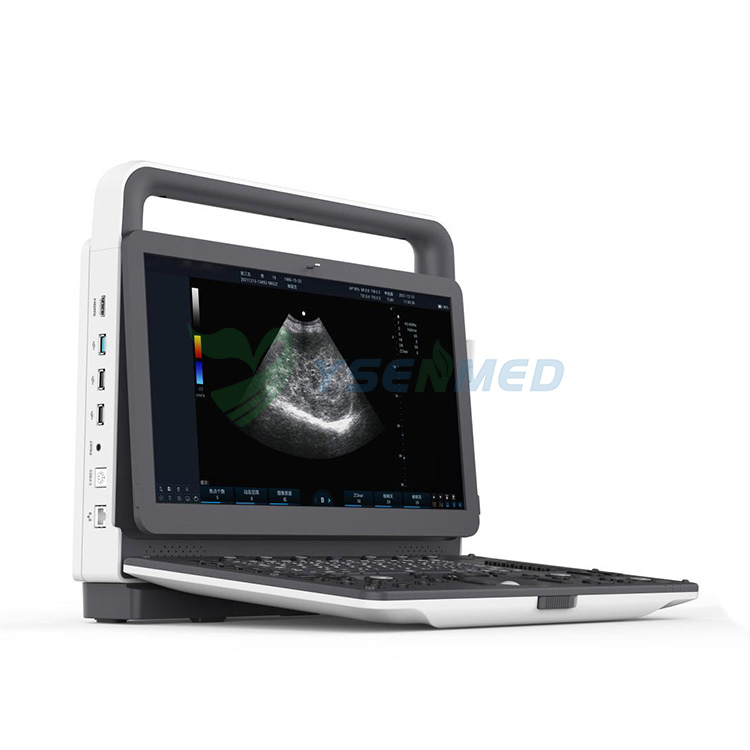 Escáner portátil de la máquina del ultrasonido de Doppler del color de la venta 3D 4D de YSB-M30 con precio bajo