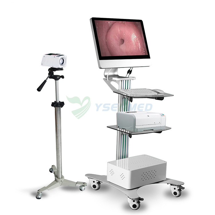 Videocolposcopio de ginecología YSSW3303